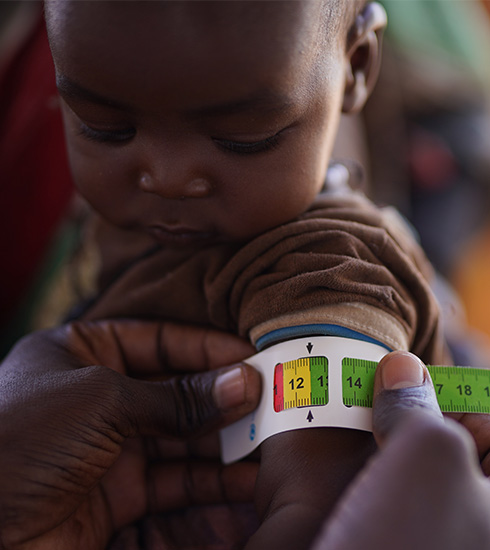 Et barn undersøkes for underernæring ved å måle overarm, Sudan